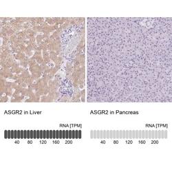 Asialoglycoprotein Receptor 2 Antibody, Novus Biologicals 0.1mL; Unlabeled:Antibodies,